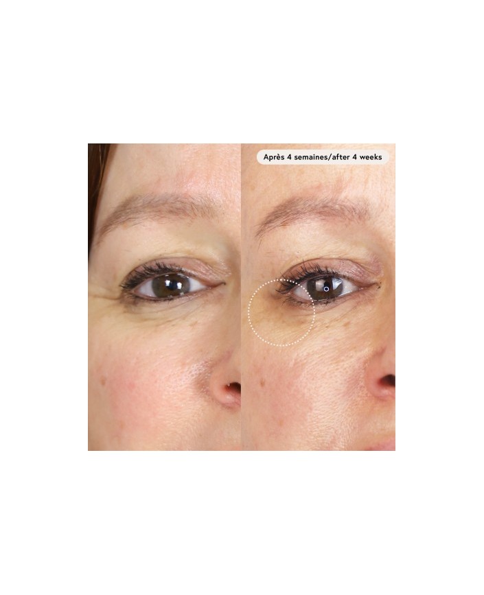 Le masque du temps - Absolution