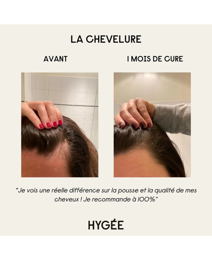 La chevelure hygee - Hygee